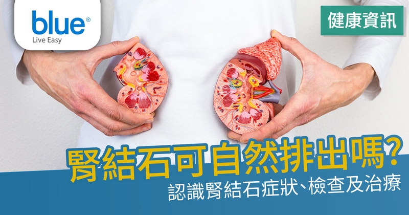 kidney-stone-symptoms-treatments-cover